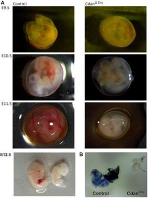 Cdan1 Is Essential for Primitive Erythropoiesis